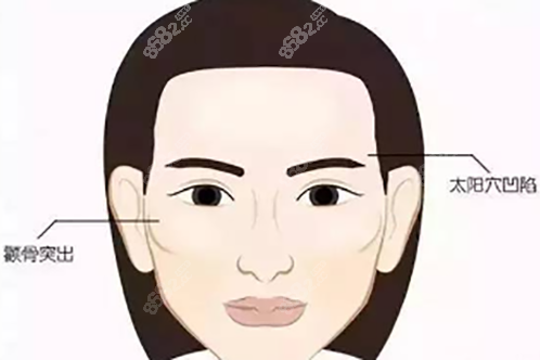 面部轮廓问题正面卡通示意图