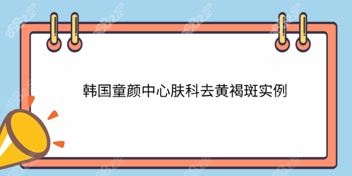 韩国童颜中心皮肤科黄褐斑治疗实例分析8682&.cc