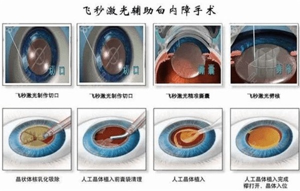 苏州博爱眼科医院