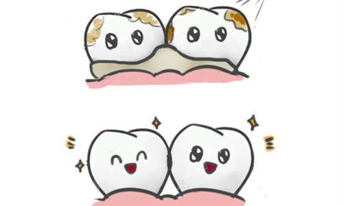 洁牙前后动画对比图.jpg