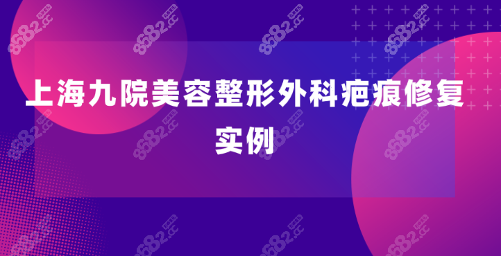 上海九院美容整形外科疤痕修复实例展示