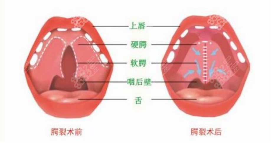 北京八大处整形医生排名,揭秘受欢迎隆胸吸脂隆鼻医生