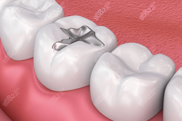 南宁岭南口腔补牙收费标准