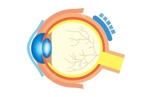 北京后巩膜加固术那个医院做的好