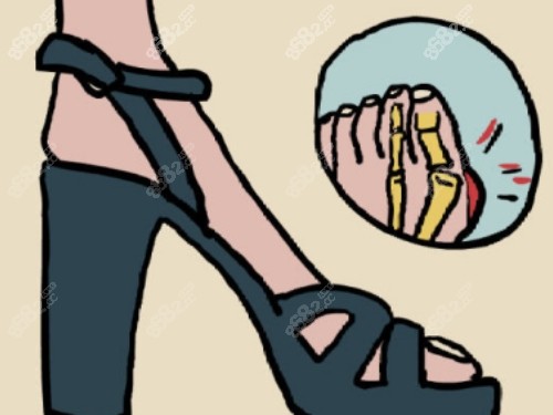 國(guó)內(nèi)拇外翻醫(yī)生排名前十