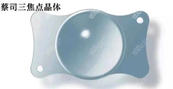 德国蔡司晶体和美国爱尔康晶体哪个好？