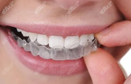 深圳登特口腔的牙齿矫正价格表