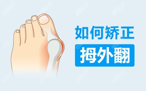 國(guó)內(nèi)拇外翻醫(yī)生排名前十