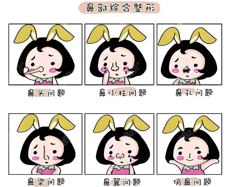 李保鍇還在上海做鼻子嗎？