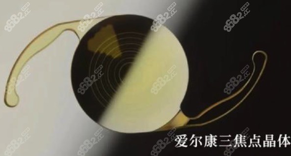 德国蔡司晶体和美国爱尔康晶体哪个好？