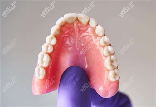 胶托义齿照片