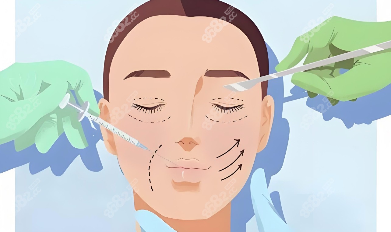 脸部縫针疤痕可通过药物治疗修复