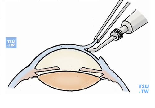 20240409303170.png 4e6d2c8539a68a54174bda13a9e57fc.png