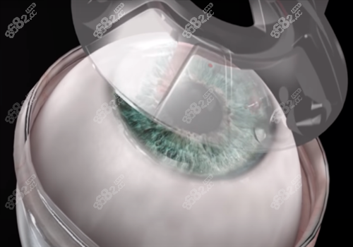 20240409303736.png 9e04a09ca994073c77f0ccd430e8cc0.png