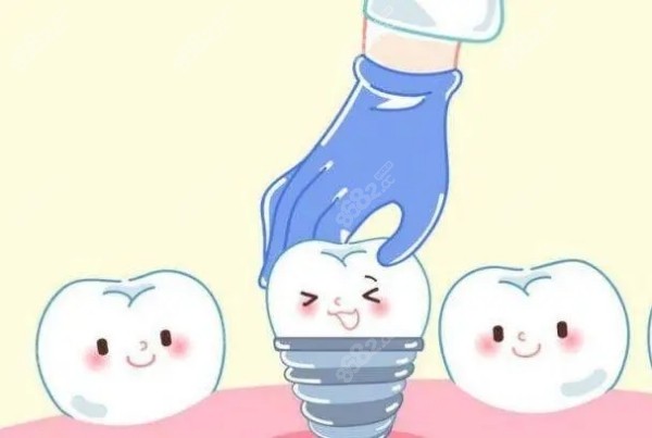 北京中诺口腔总院种植牙技术好