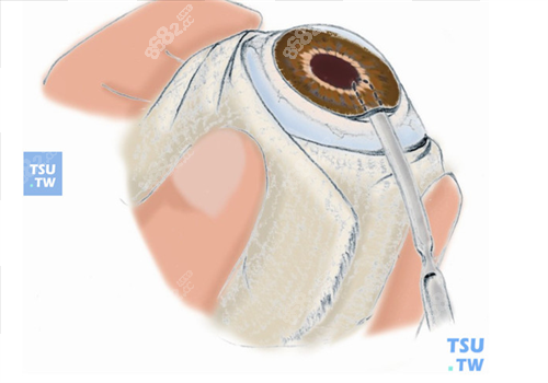 20240409586551.png 16cccdf173547610b3d4596e663ead7.png