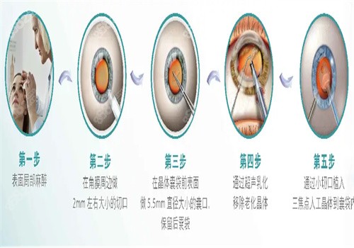 北京熙仁眼科医院设备先进