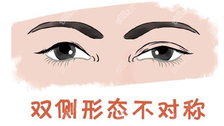 成都林靖修复后的眼睛自然