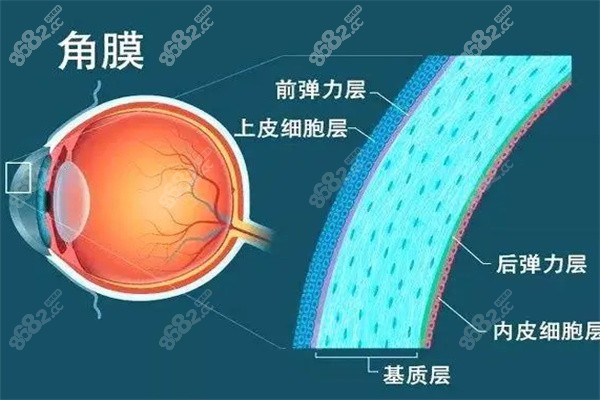 爱尔眼科板层角膜移植术