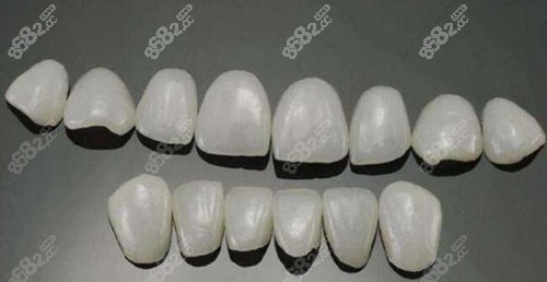 牙齿瓷贴面材料