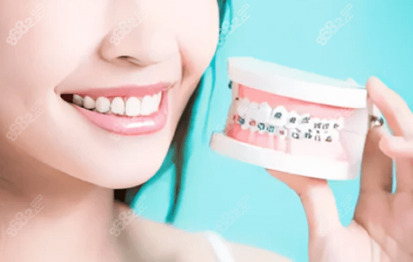 南京茀莱堡口腔牙齿矫正收费标准
