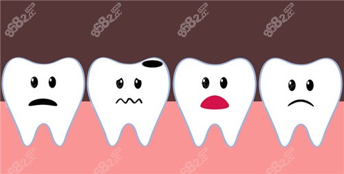 牙齿龋坏动画图