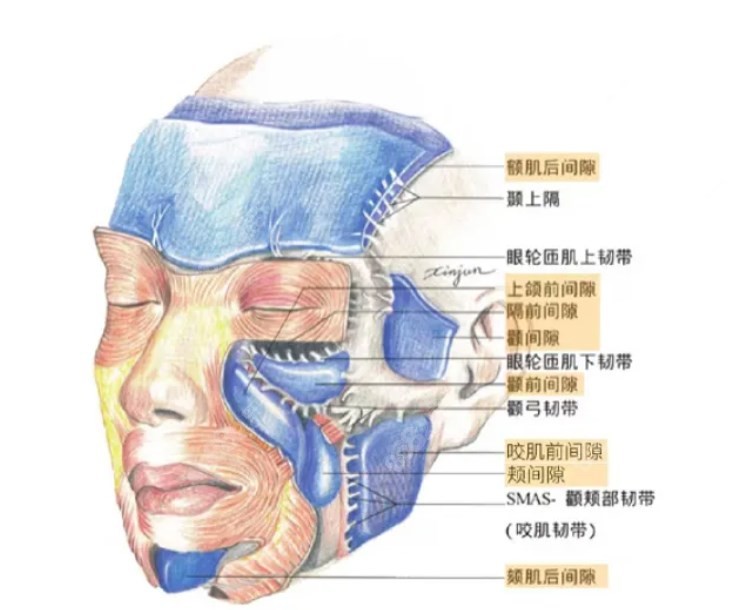 拉皮技术