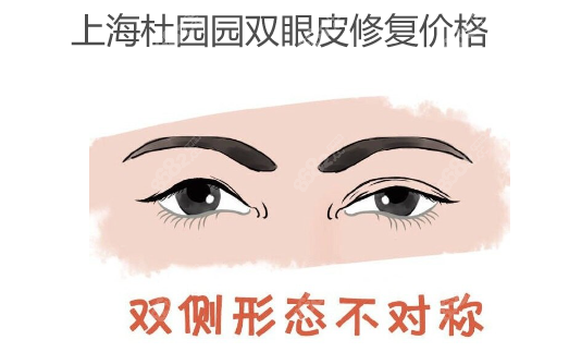 上海杜园园双眼皮修复价格