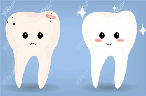 健康牙齿和龋坏牙齿卡通示意图