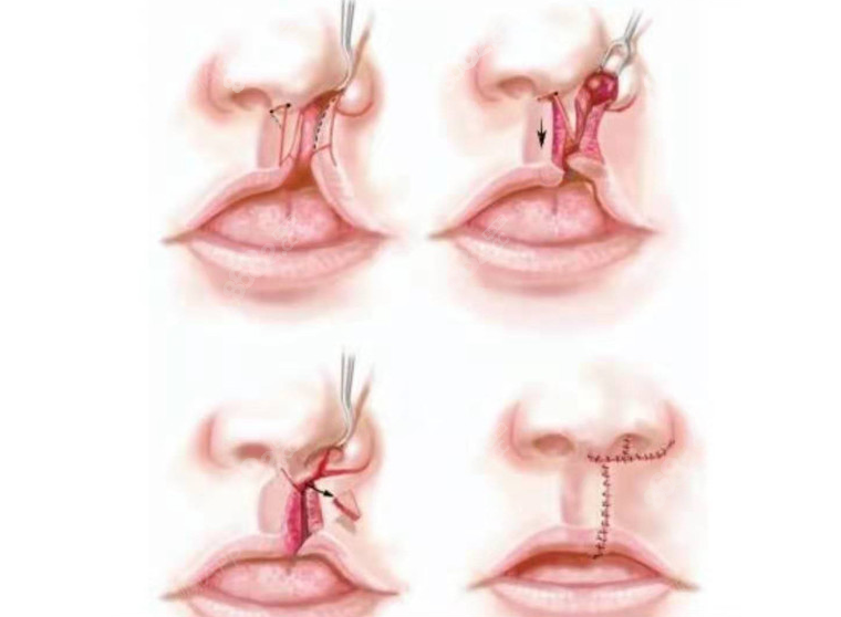 唇腭裂挂什么科