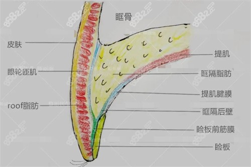 师丽丽双眼皮修复组织.jpg