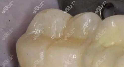 晋江市牙科诊所哪里比较好 分享晋江市排行前十的靠谱牙科