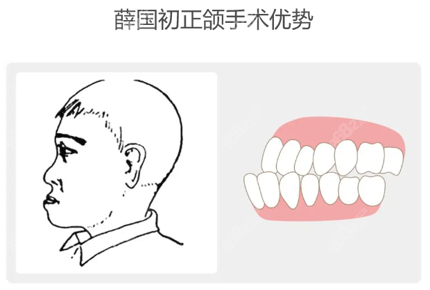 薛国初正颌手术优势