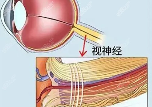 视神经萎缩眼球会有什么变化