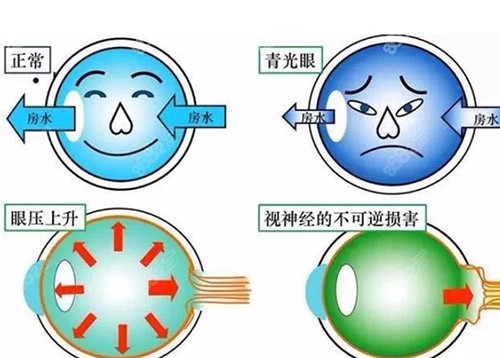 视神经萎缩有办法治疗吗