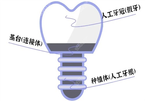 2024<!--<i data=20240705-sp></i>-->（格莱美）口腔价格表