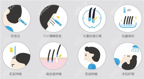 沈阳杏林整形医院植发怎么样？
