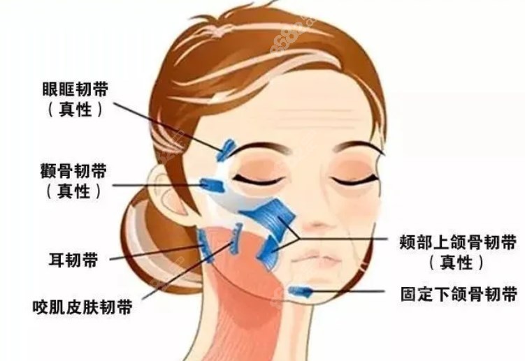 面部支架提升