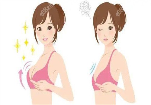 液态丰胸/胶原蛋白丰胸/自体脂肪丰胸区别