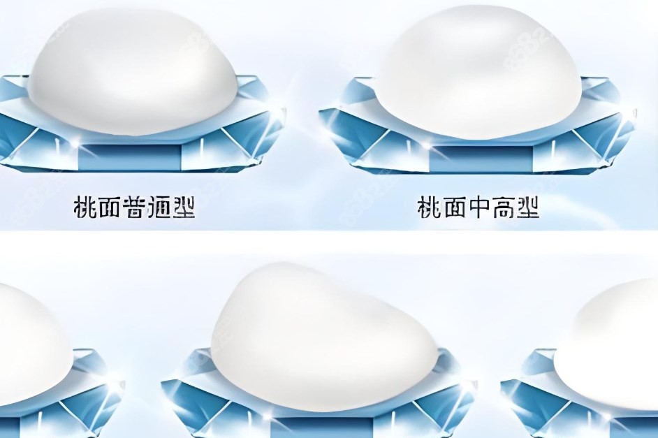 胸部假体