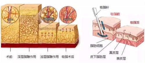 林金德医生的医术水平有多高