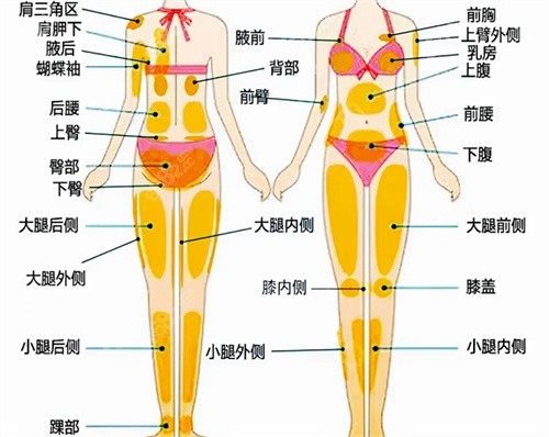 南京吸脂手术哪家医院好