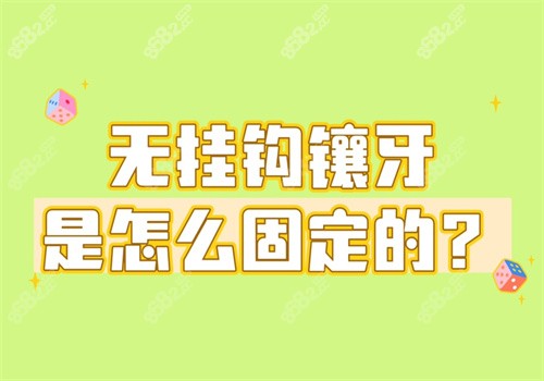 无挂钩镶牙是怎么固定的