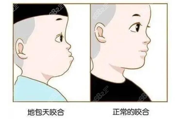 矫正的前后变化图8682.cc