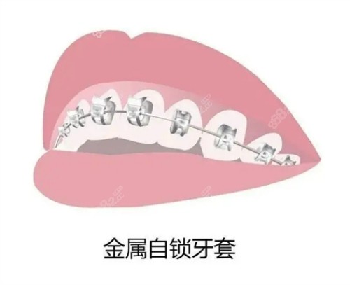 长春拜博口腔医院牙齿矫正做的好