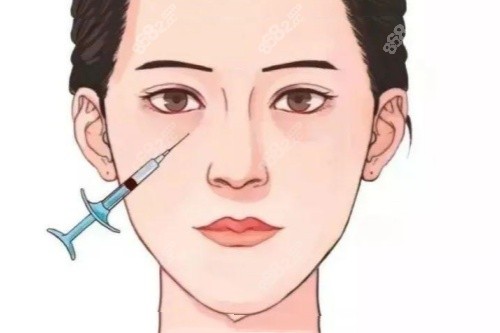 眼部注射卡通图.jpg