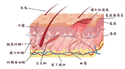 增生疤痕是怎么形成的.jpg