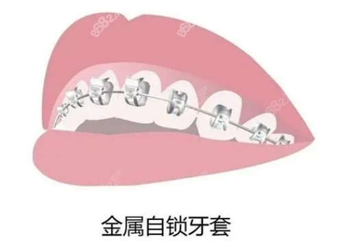 厦门市麦芽口腔医院口碑不错