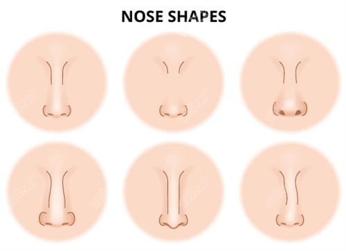 不同需要矫正的鼻子