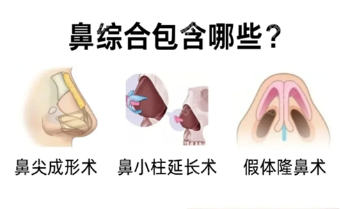 鼻综合手术项目类别.png